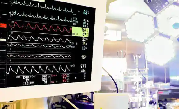 Intraoperatives Monitoring Überwachung Neuromobil
